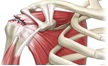 Estágio em Cirurgia de Ombro e Cotovelo 